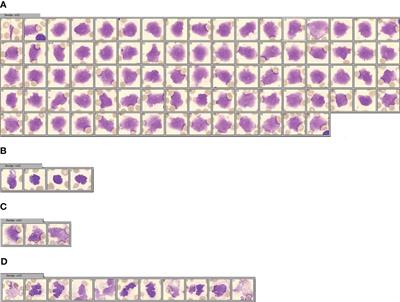 An early warning indicator of mortality risk in patients with COVID-19: the neutrophil extracellular traps/neutrophilic segmented granulocyte ratio